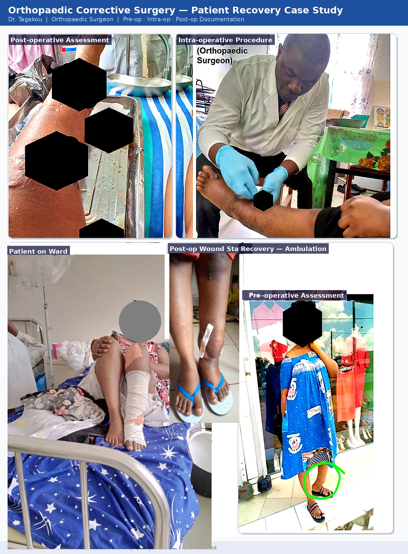 Documenting a patient's journey through corrective orthopaedic surgery sponsored by Michael GG Foundation — from pre-operative assessment to post-operative recovery — under the care of Dr. Tagakou, Orthopaedic Surgeon.
